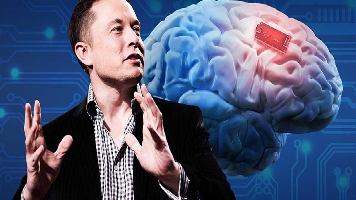 The Rajkotupdates.news : Elon Musk in 2022 Neuralink Start to Implantation of Brain Chips in Humans
